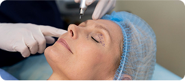 blefaroplastia-com-laser em Rio Verde